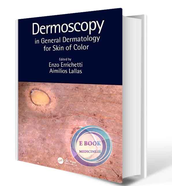 دانلود کتاب Dermoscopy in General Dermatology for Skin of Color    2021 (ORIGINAL PDF)